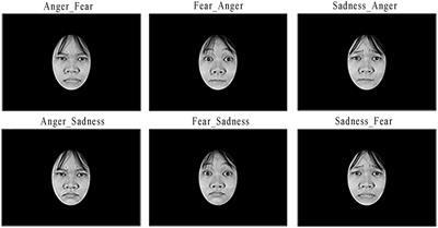 Evidence for Anger Saliency during the Recognition of Chimeric Facial Expressions of Emotions in Underage Ebola Survivors